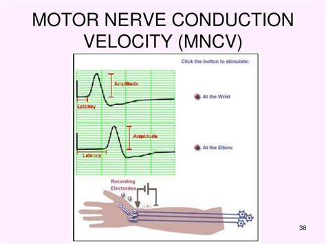 ELECTROMYOGRAPHY AND NERVE CONDUCTION VELOCITY (EMG.